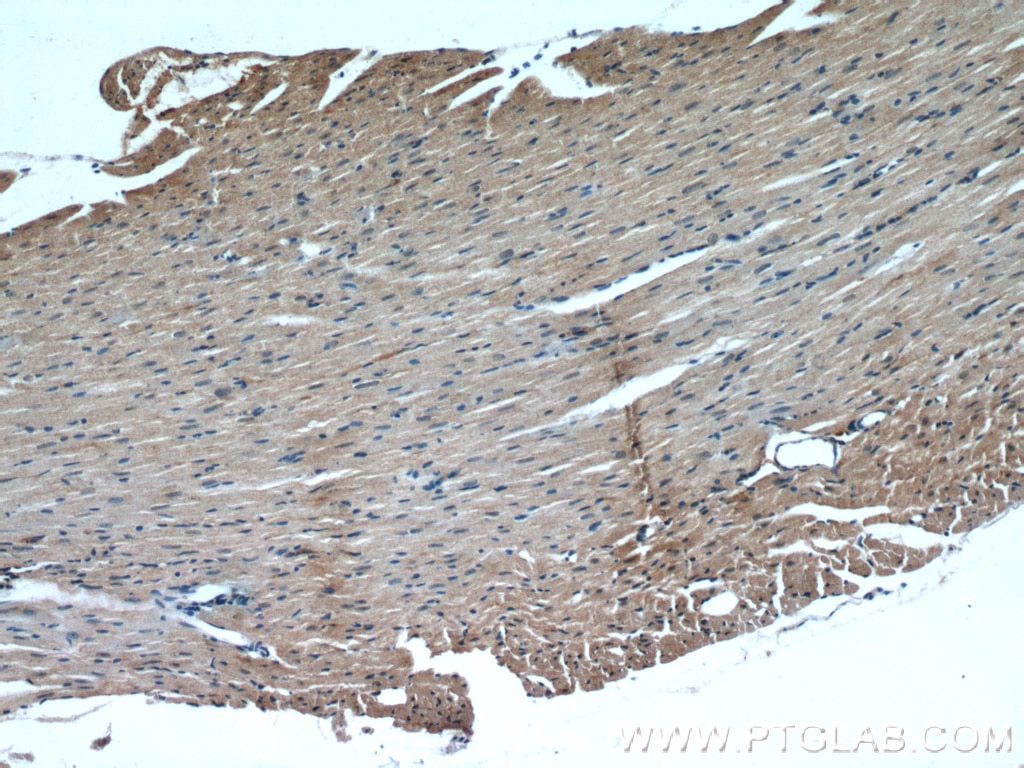 Immunohistochemistry (IHC) staining of mouse heart tissue using TRIM63 Polyclonal antibody (55456-1-AP)