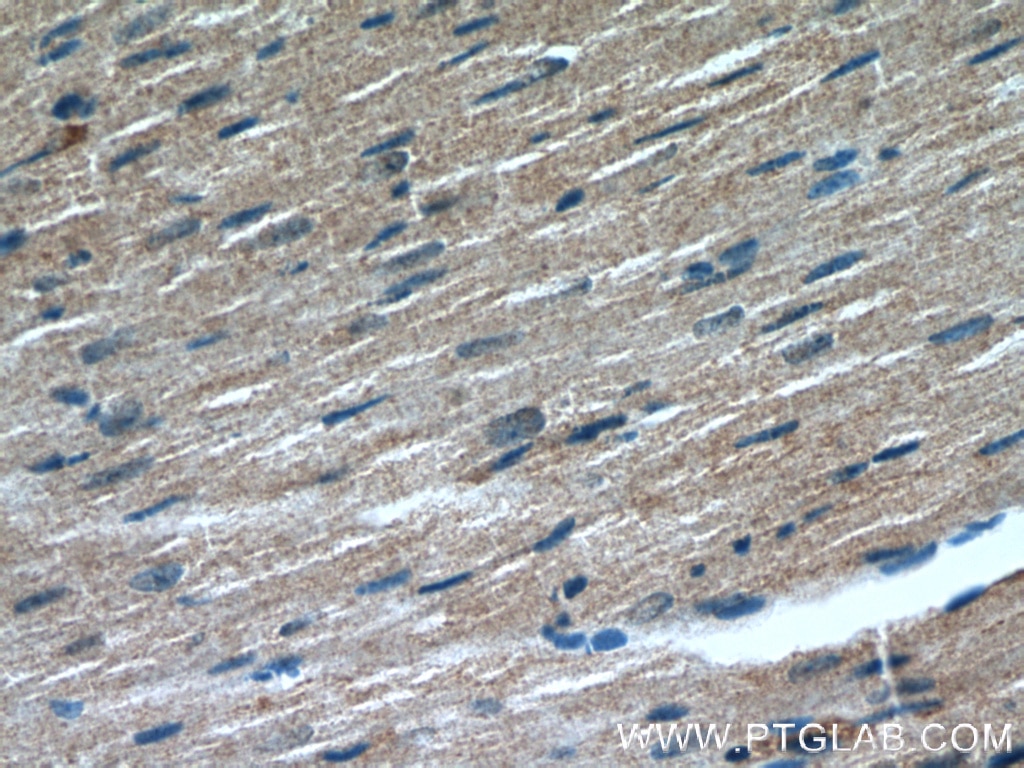 Immunohistochemistry (IHC) staining of mouse heart tissue using TRIM63 Polyclonal antibody (55456-1-AP)