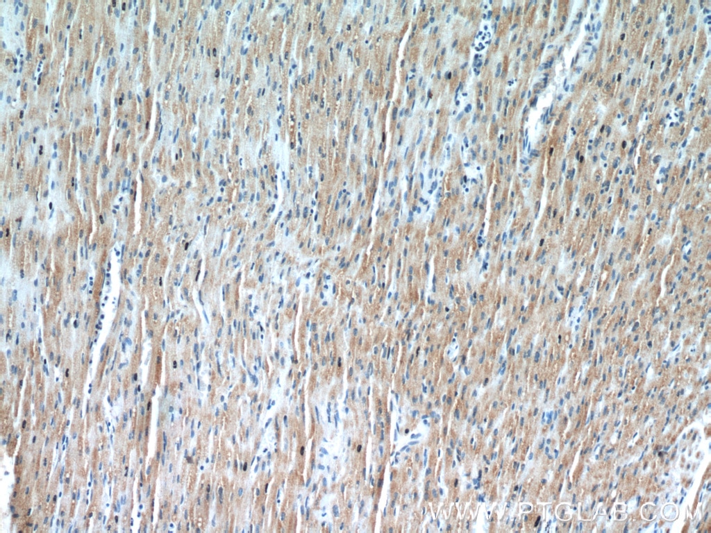 Immunohistochemistry (IHC) staining of human heart tissue using TRIM63 Polyclonal antibody (55456-1-AP)