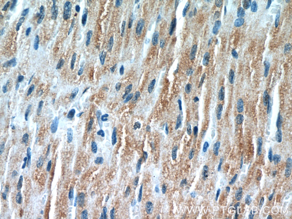 Immunohistochemistry (IHC) staining of human heart tissue using TRIM63 Polyclonal antibody (55456-1-AP)