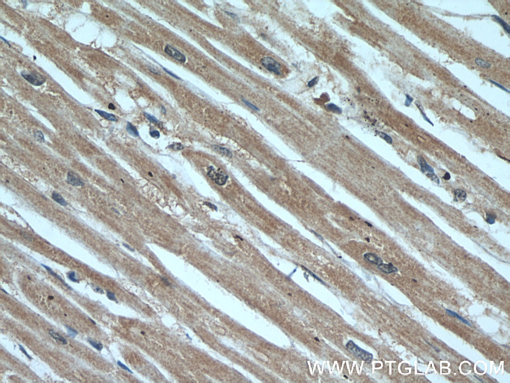 IHC staining of human heart using 55456-1-AP