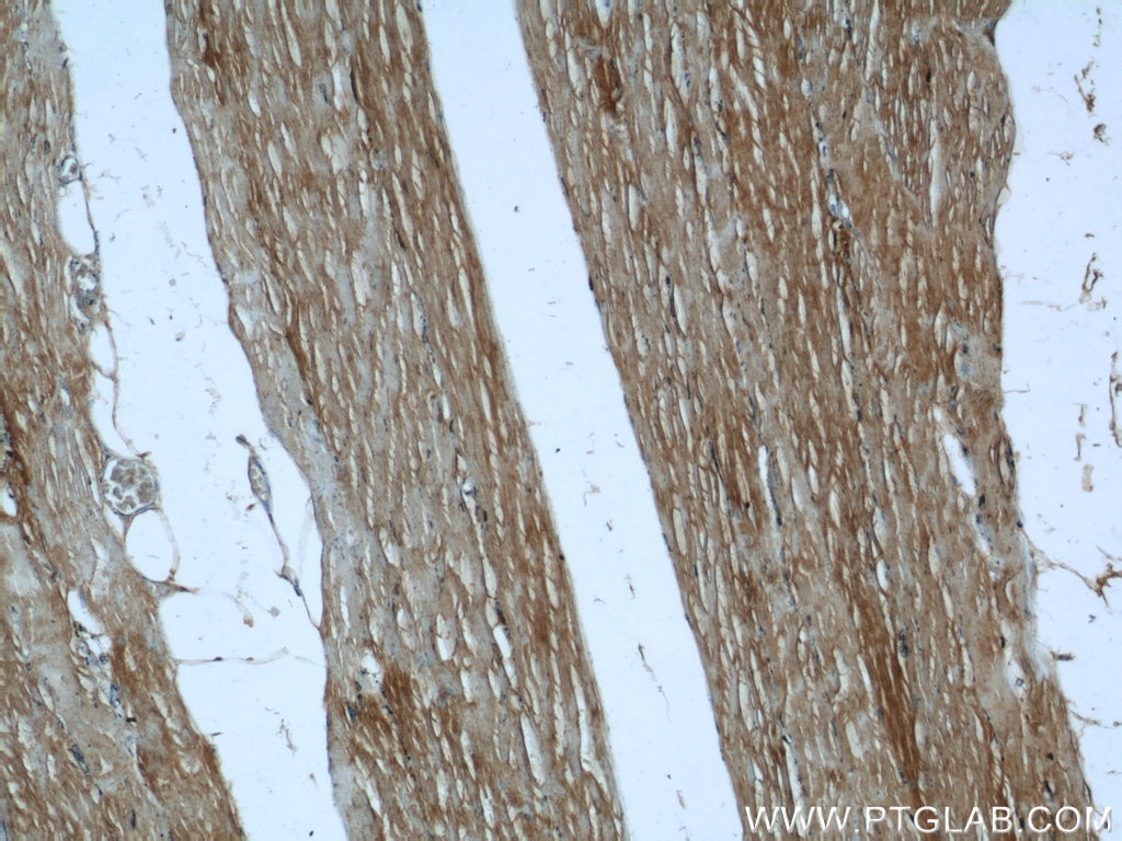 Immunohistochemistry (IHC) staining of human skeletal muscle tissue using TRIM63 Polyclonal antibody (55456-1-AP)