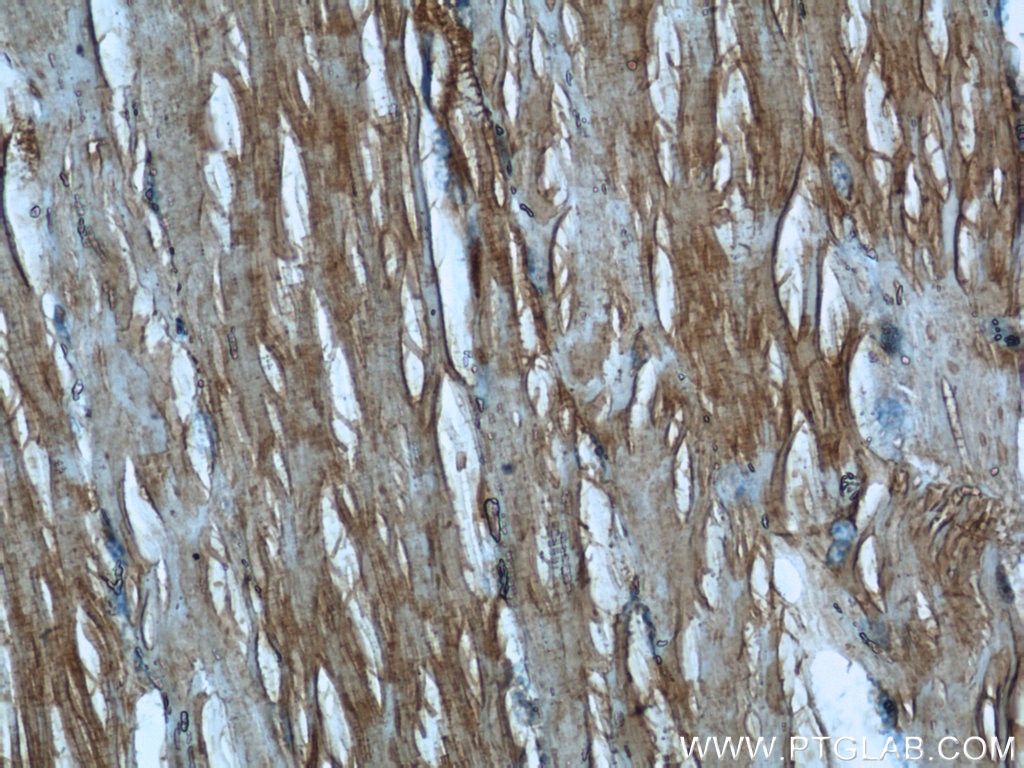 Immunohistochemistry (IHC) staining of human skeletal muscle tissue using TRIM63 Polyclonal antibody (55456-1-AP)