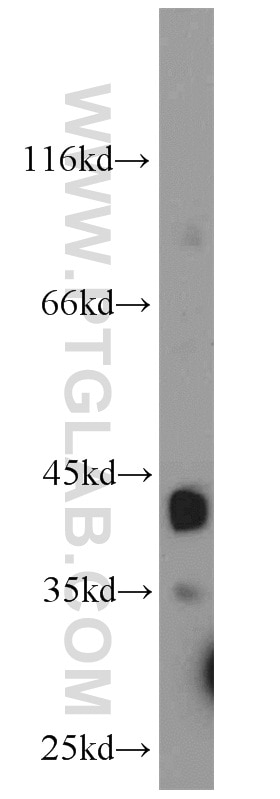 TRIM63 Polyclonal antibody