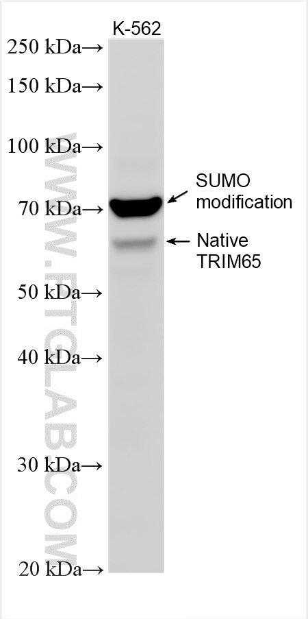 WB analysis using 31990-1-AP Western Blot (WB) analysis of various lysates using TRIM65 Polyclonal antibody (31990-1-AP)