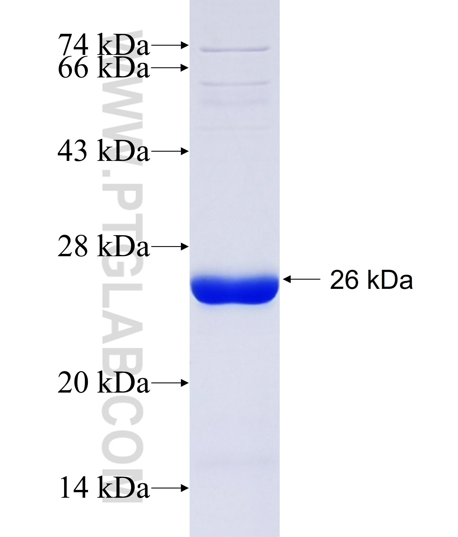 TRIM65 fusion protein Ag34611 SDS-PAGE TRIM65 fusion protein Ag34611 SDS-PAGE