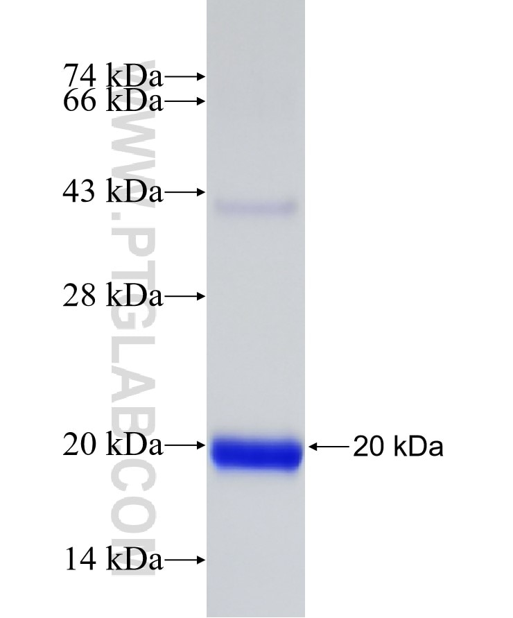 TRIM66 fusion protein Ag30404 SDS-PAGE TRIM66 fusion protein Ag30404 SDS-PAGE