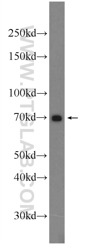 Western Blot (WB) analysis of HepG2 cells using TRIM67 Polyclonal antibody (24369-1-AP)