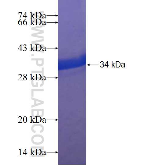 TRIM67 fusion protein Ag21632 SDS-PAGE