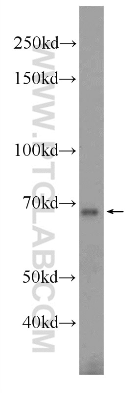 Western Blot (WB) analysis of mouse testis tissue using TRIM69 Polyclonal antibody (12951-1-AP)