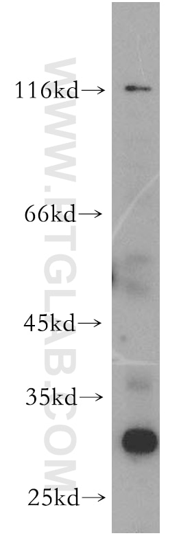 Western Blot (WB) analysis of HeLa cells using TRIM69 Polyclonal antibody (12951-1-AP)