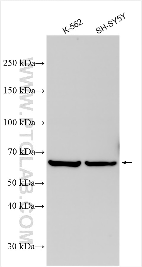 Western Blot (WB) analysis of various lysates using TRIM69 Polyclonal antibody (29907-1-AP)