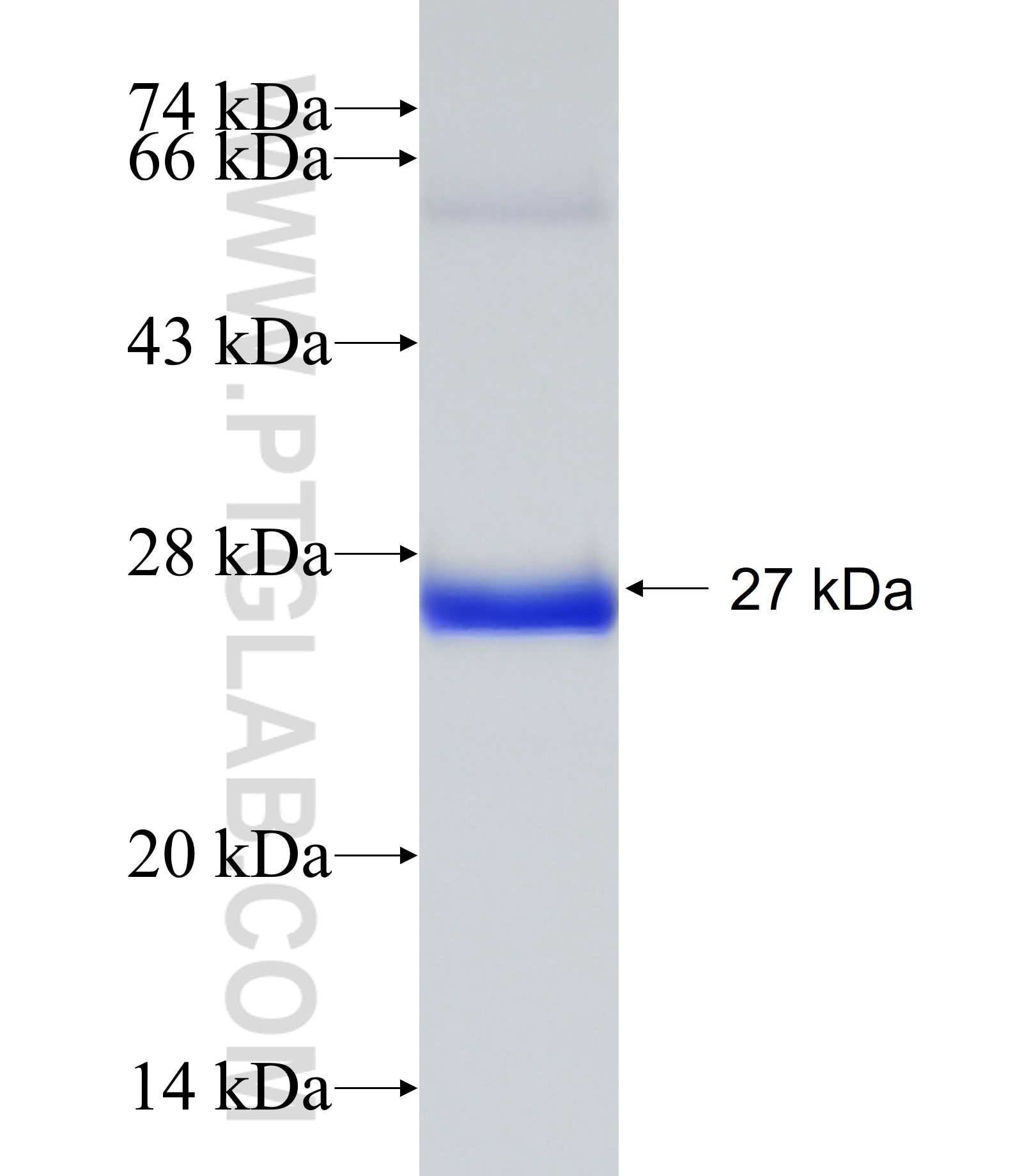 TRIM69 fusion protein Ag31757 SDS-PAGE
