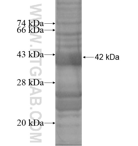 TRIM69 fusion protein Ag14449 SDS-PAGE