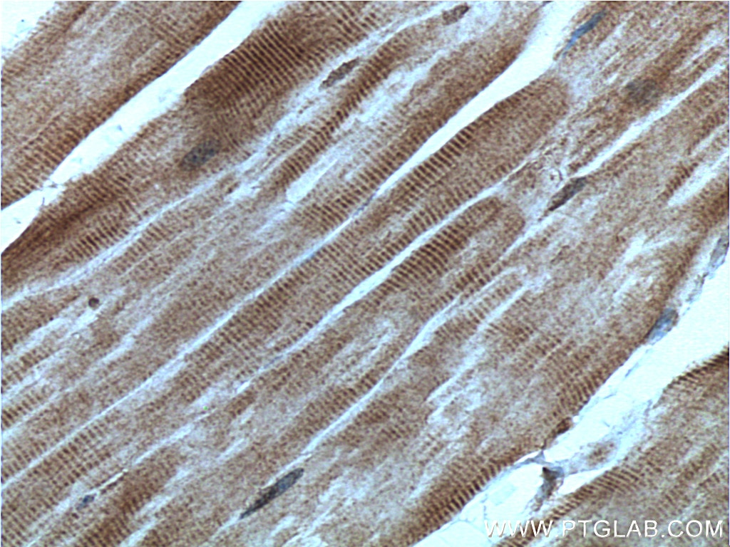 IHC staining of mouse skeletal muscle using 26285-1-AP