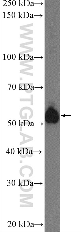 WB analysis of mouse heart using 26285-1-AP