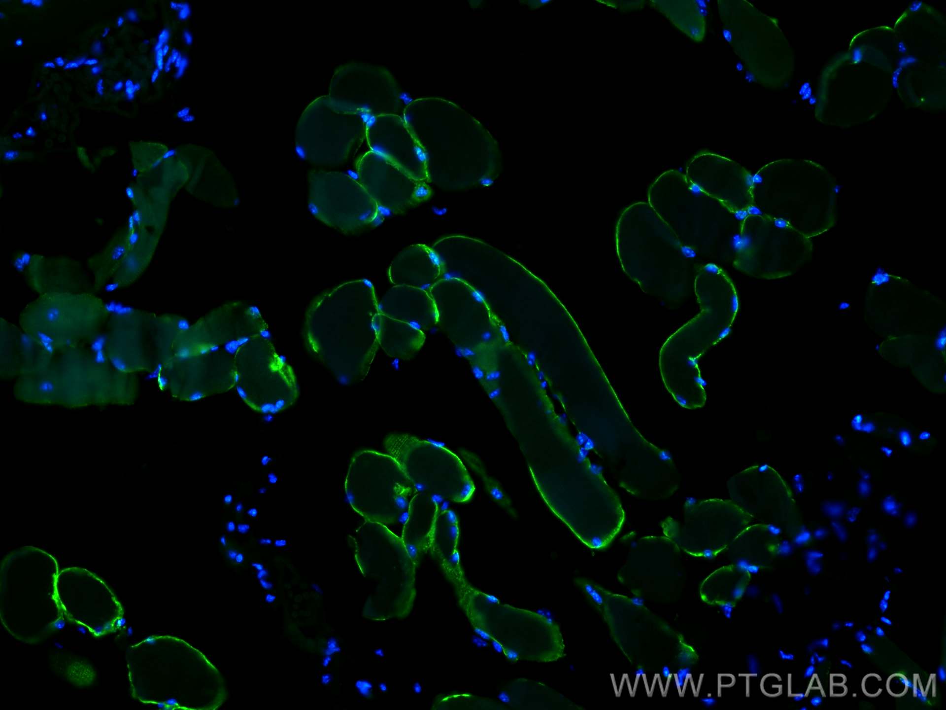 Immunofluorescence (IF) / fluorescent staining of mouse skeletal muscle tissue using TRIM72 Polyclonal antibody (22151-1-AP)