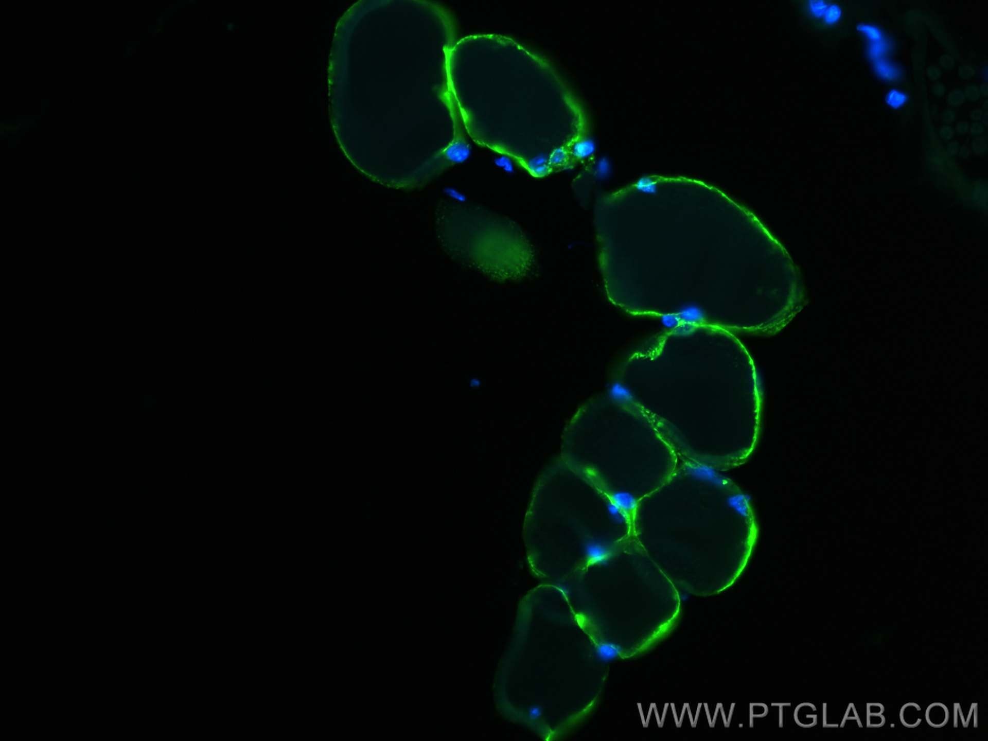 Immunofluorescence (IF) / fluorescent staining of mouse skeletal muscle tissue using TRIM72 Polyclonal antibody (22151-1-AP)