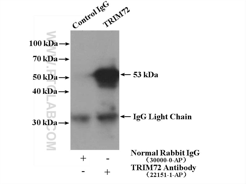 Immunoprecipitation (IP) experiment of mouse heart tissue using TRIM72 Polyclonal antibody (22151-1-AP)