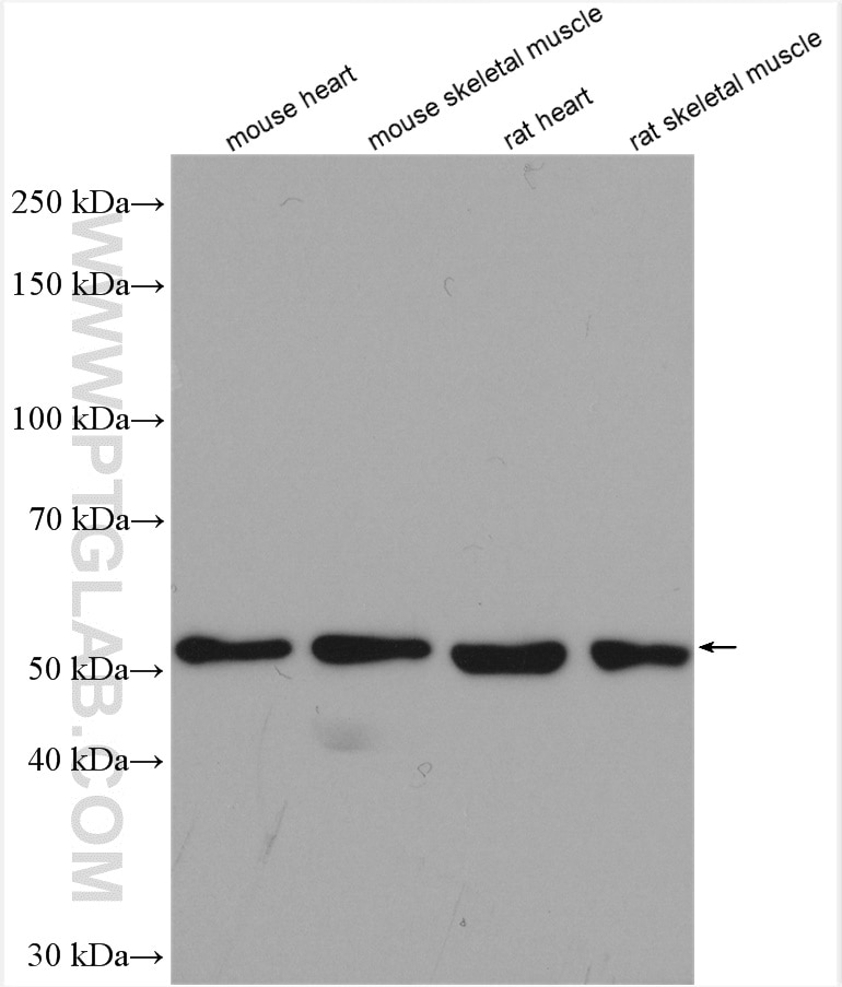 Western Blot (WB) analysis of various lysates using TRIM72 Polyclonal antibody (22151-1-AP)