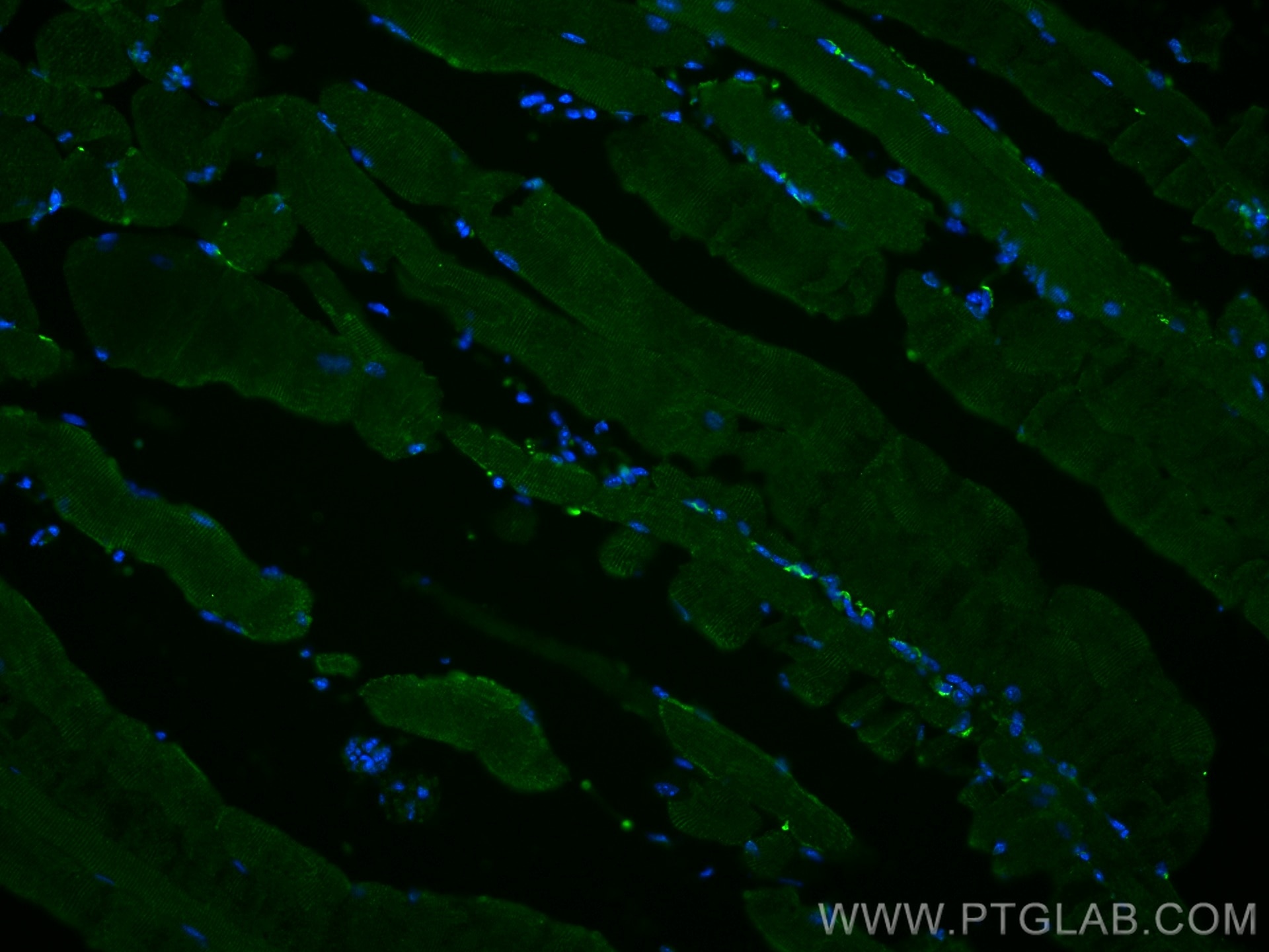 Immunofluorescence (IF) / fluorescent staining of mouse skeletal muscle tissue using TRIM72 Monoclonal antibody (67403-1-Ig)