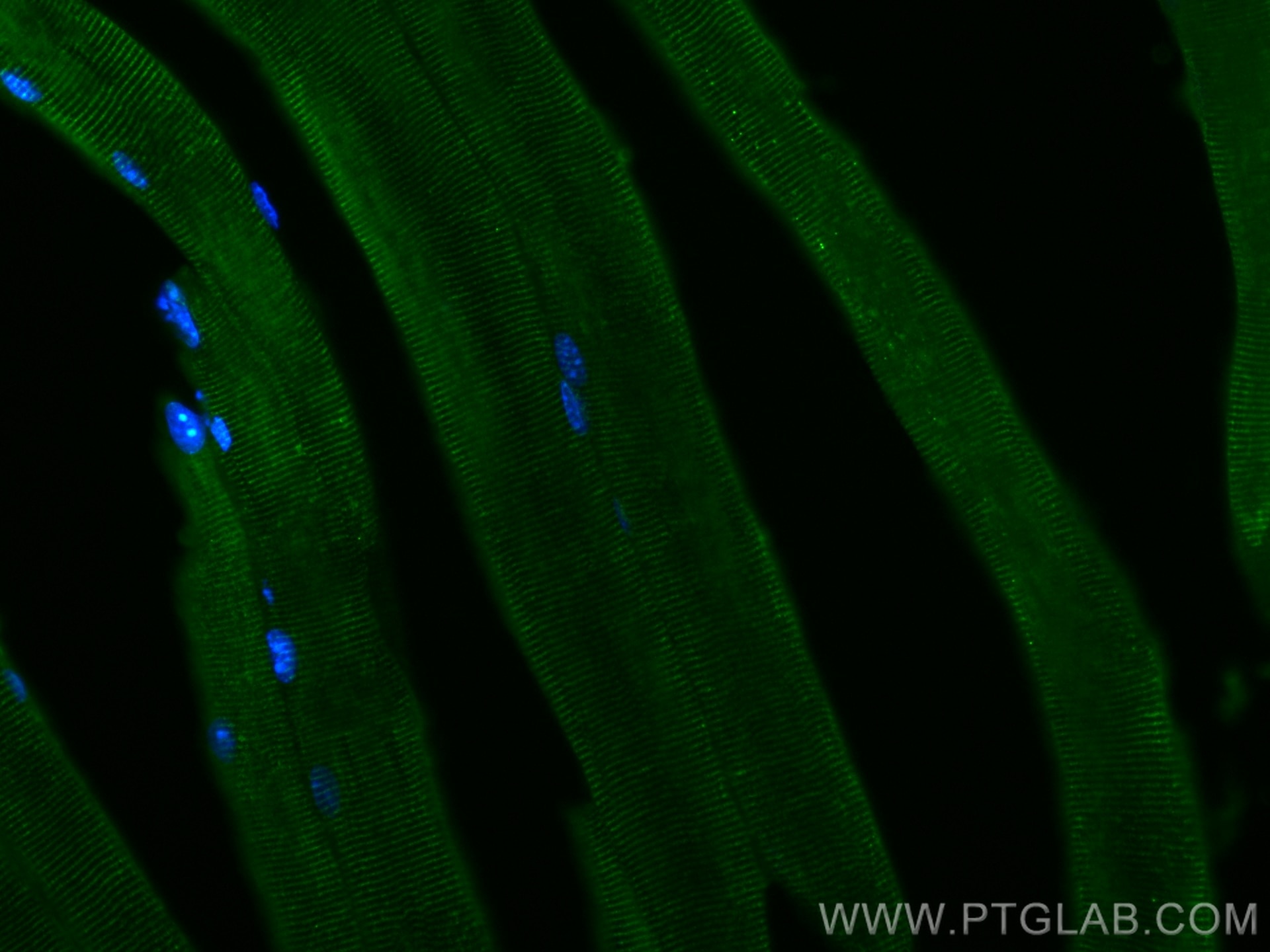 Immunofluorescence (IF) / fluorescent staining of mouse skeletal muscle tissue using TRIM72 Monoclonal antibody (67403-1-Ig)