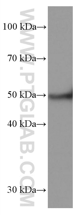 Western Blot (WB) analysis of pig heart tissue using TRIM72 Monoclonal antibody (67403-1-Ig)