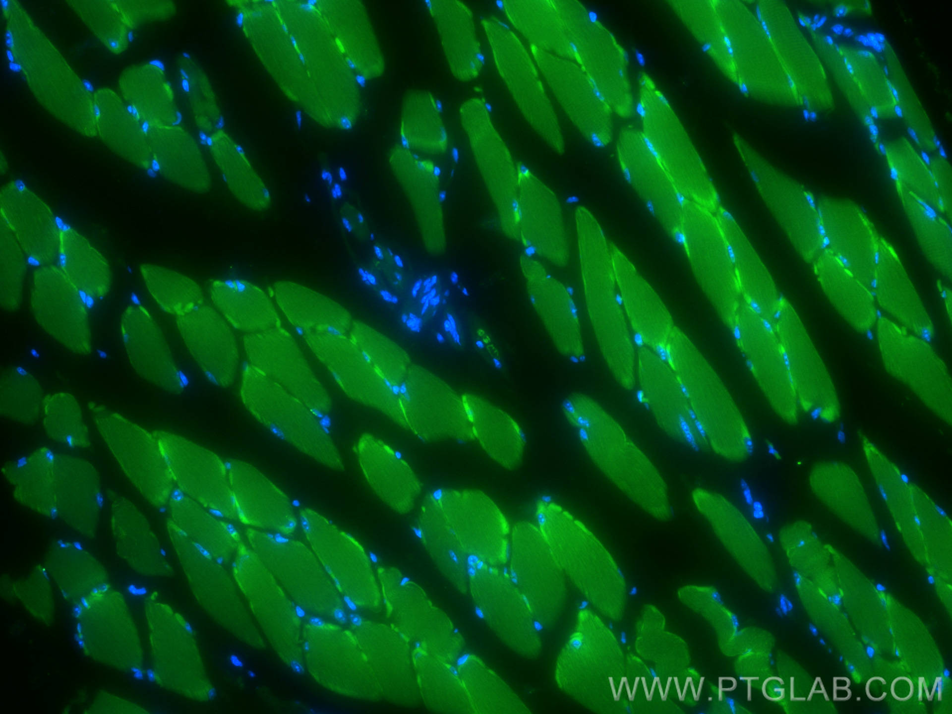 Immunofluorescence (IF) / fluorescent staining of mouse skeletal muscle tissue using CoraLite® Plus 488-conjugated TRIM72 Monoclonal an (CL488-67403)