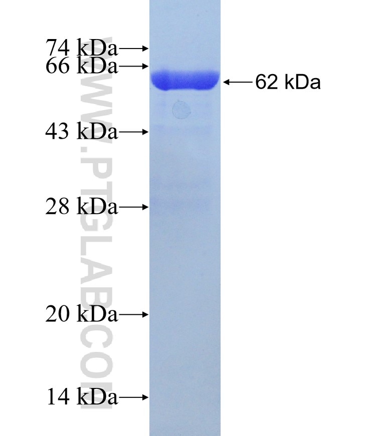 TRIM72 fusion protein Ag12048 SDS-PAGE