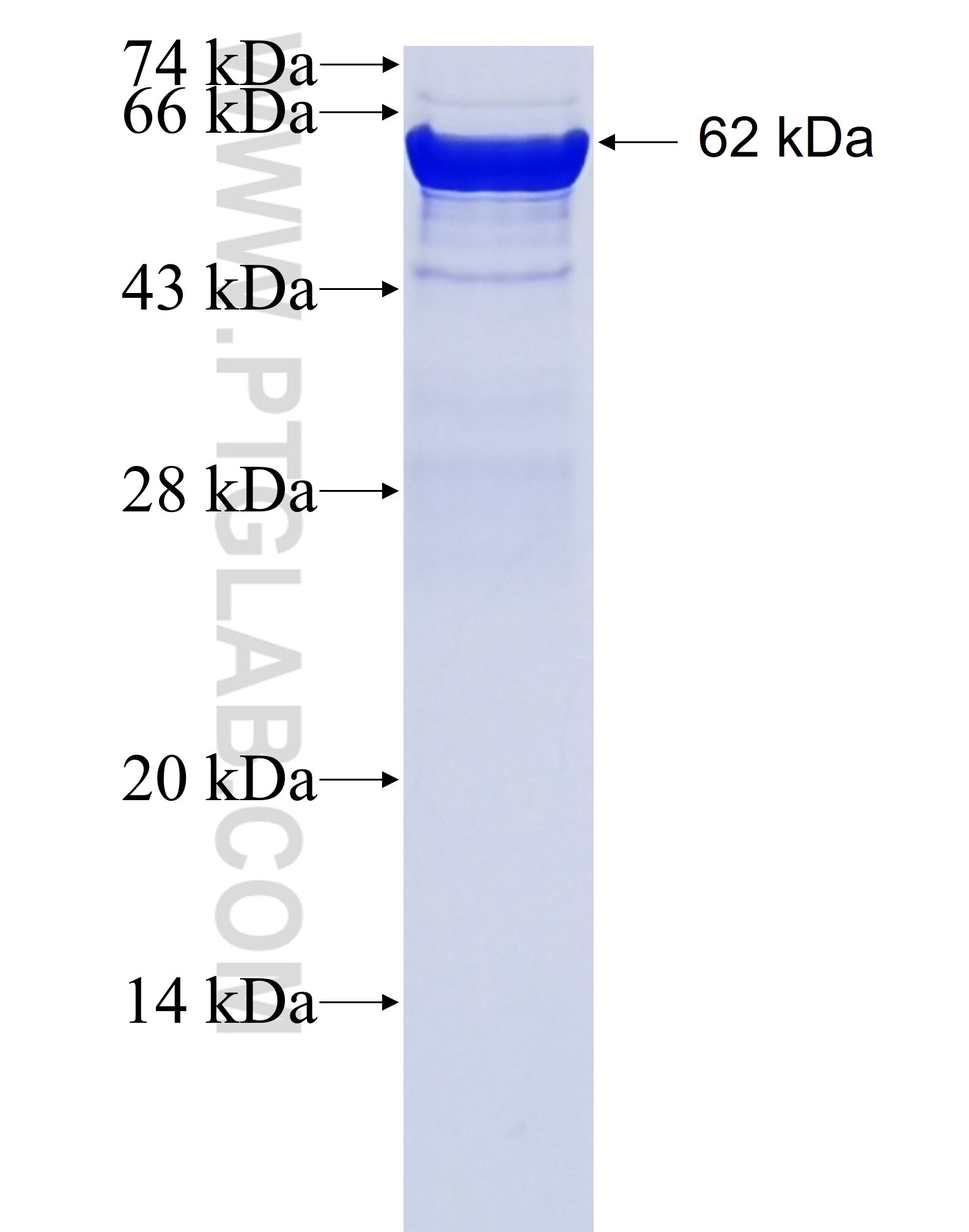 TRIM72 fusion protein Ag12048 SDS-PAGE