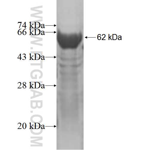 TRIM72 fusion protein Ag2560 SDS-PAGE