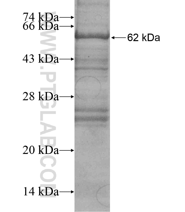 TRIM72 fusion protein Ag17756 SDS-PAGE