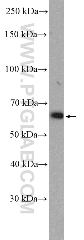 Western Blot (WB) analysis of L02 cells using TRIM8 Polyclonal antibody (27463-1-AP)