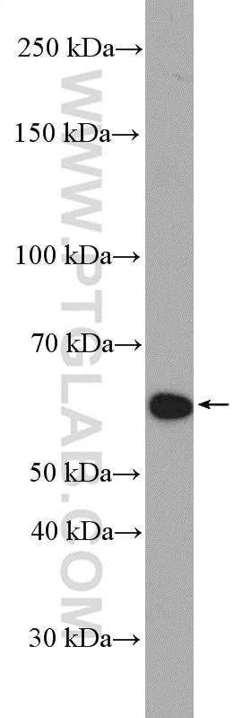Western Blot (WB) analysis of HepG2 cells using TRIM8 Polyclonal antibody (27463-1-AP)
