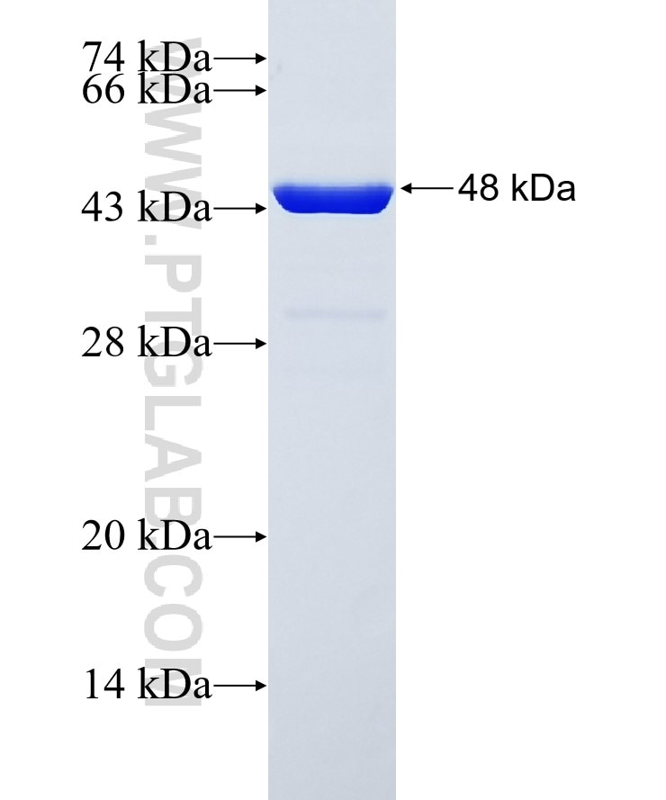 TRIM8 fusion protein Ag26517 SDS-PAGE