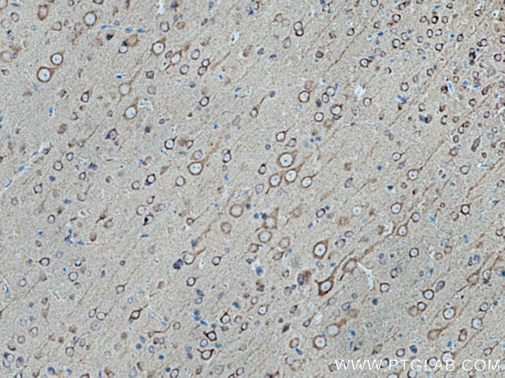 Immunohistochemistry (IHC) staining of rat brain tissue using TRIM9 Polyclonal antibody (10786-1-AP)