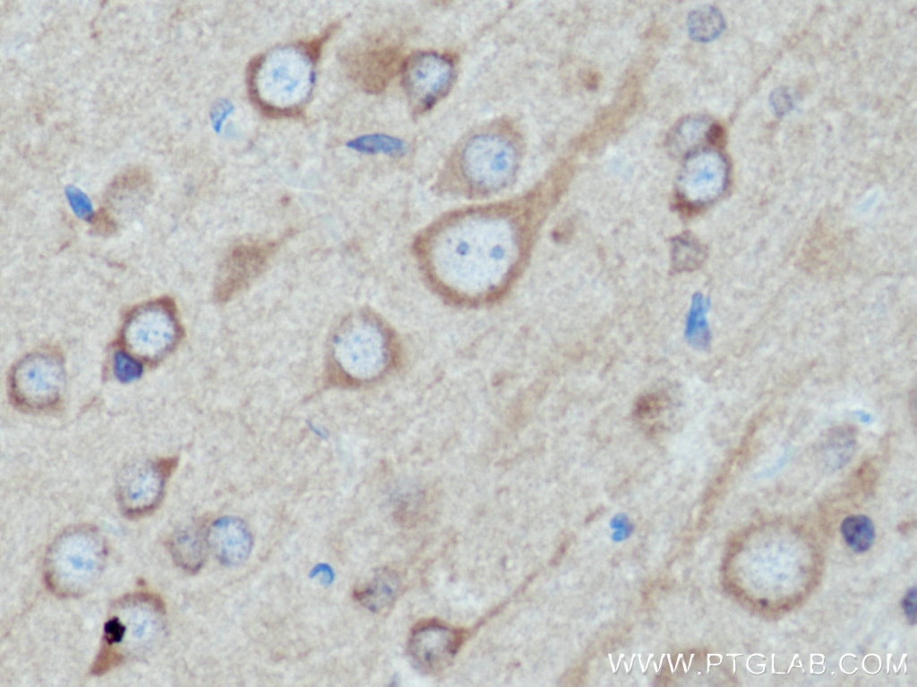 IHC staining of rat brain using 10786-1-AP