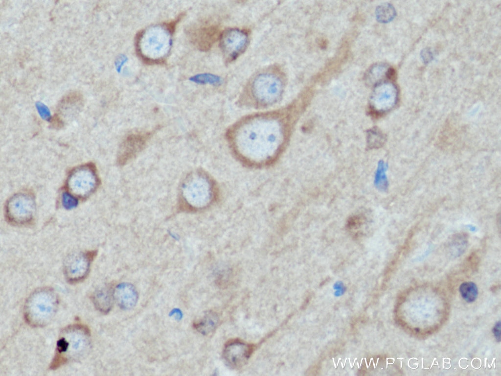 Immunohistochemistry (IHC) staining of rat brain tissue using TRIM9 Polyclonal antibody (10786-1-AP)