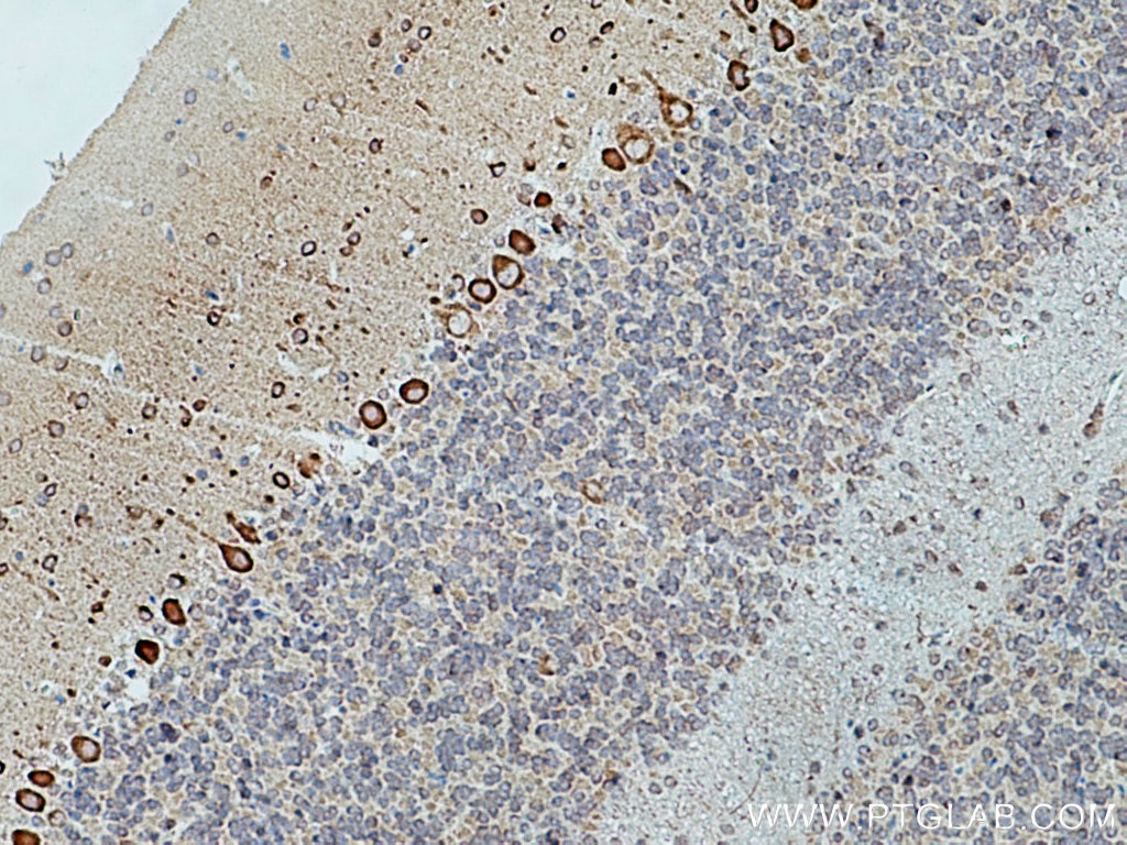Immunohistochemistry (IHC) staining of rat cerebellum tissue using TRIM9 Polyclonal antibody (10786-1-AP)