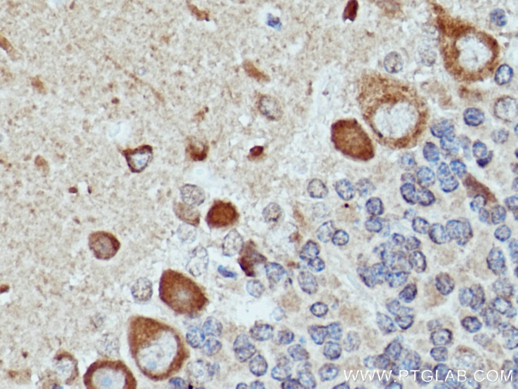 Immunohistochemistry (IHC) staining of rat cerebellum tissue using TRIM9 Polyclonal antibody (10786-1-AP)