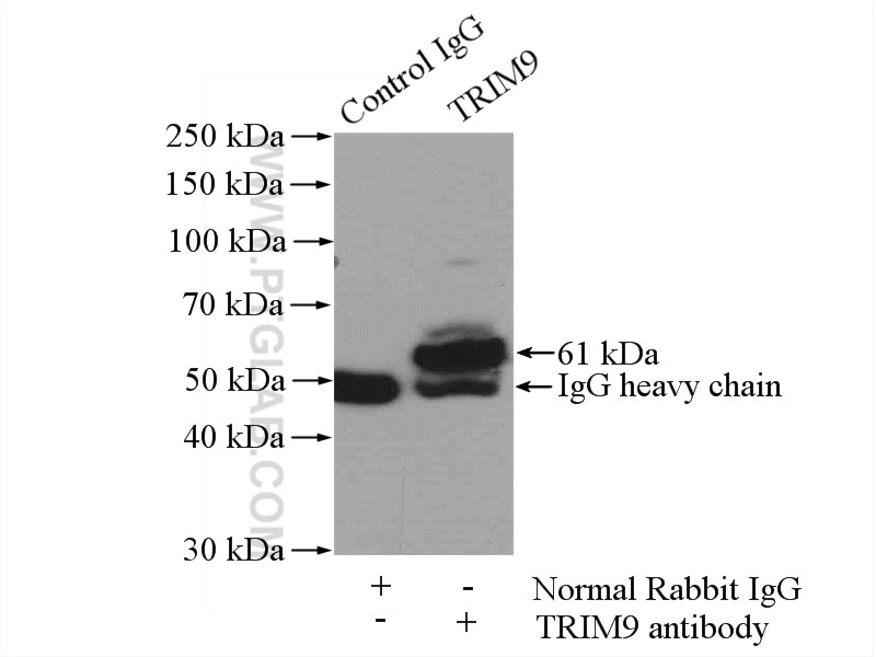 Immunoprecipitation (IP) experiment of mouse brain tissue using TRIM9 Polyclonal antibody (10786-1-AP)