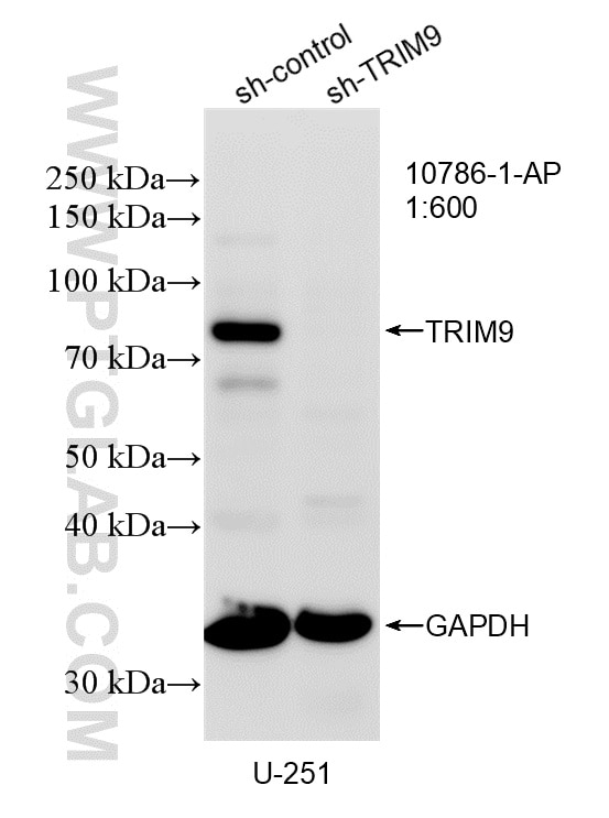 WB result of TRIM9 antibody (10786-1-AP; 1:600; incubated at room temperature for 1.5 hours) with sh-Control and sh-TRIM9 transfected U-251 cells. Western Blot (WB) analysis of U-251 cells using TRIM9 Polyclonal antibody (10786-1-AP)
