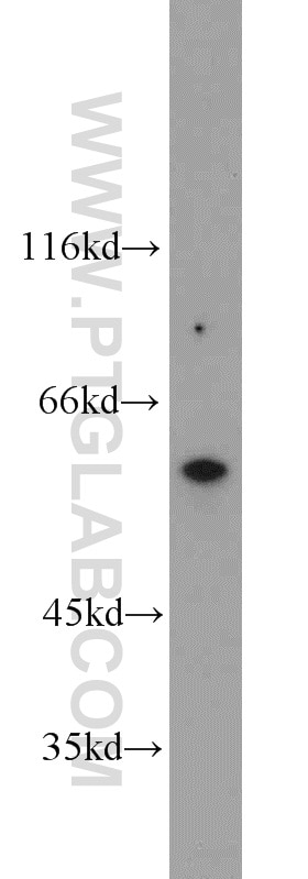 Western Blot (WB) analysis of HepG2 cells using TRIM9 Polyclonal antibody (10786-1-AP)