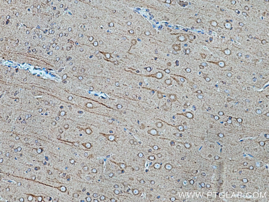 Immunohistochemistry (IHC) staining of rat brain tissue using TRIM9 Monoclonal antibody (67268-1-Ig)