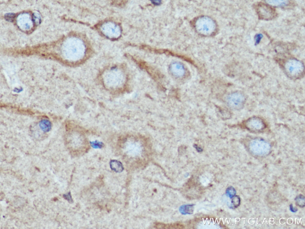 Immunohistochemistry (IHC) staining of rat brain tissue using TRIM9 Monoclonal antibody (67268-1-Ig)