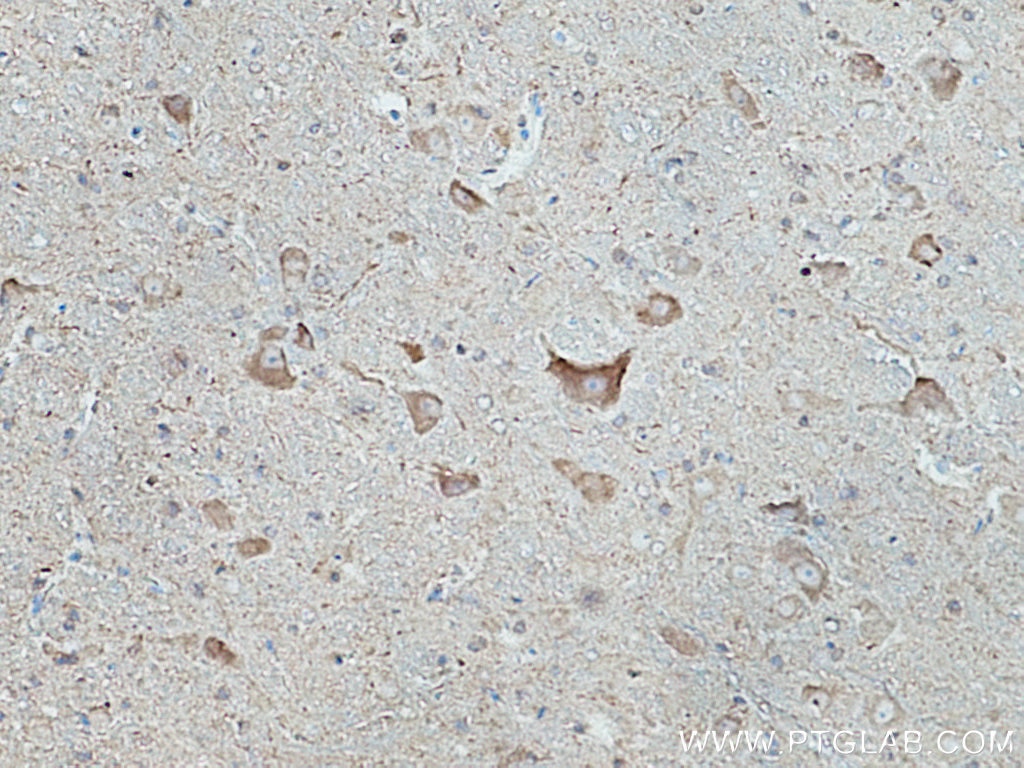 Immunohistochemistry (IHC) staining of rat cerebellum tissue using TRIM9 Monoclonal antibody (67268-1-Ig)