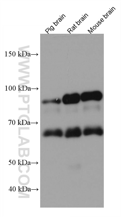 Western Blot (WB) analysis of various lysates using TRIM9 Monoclonal antibody (67268-1-Ig)