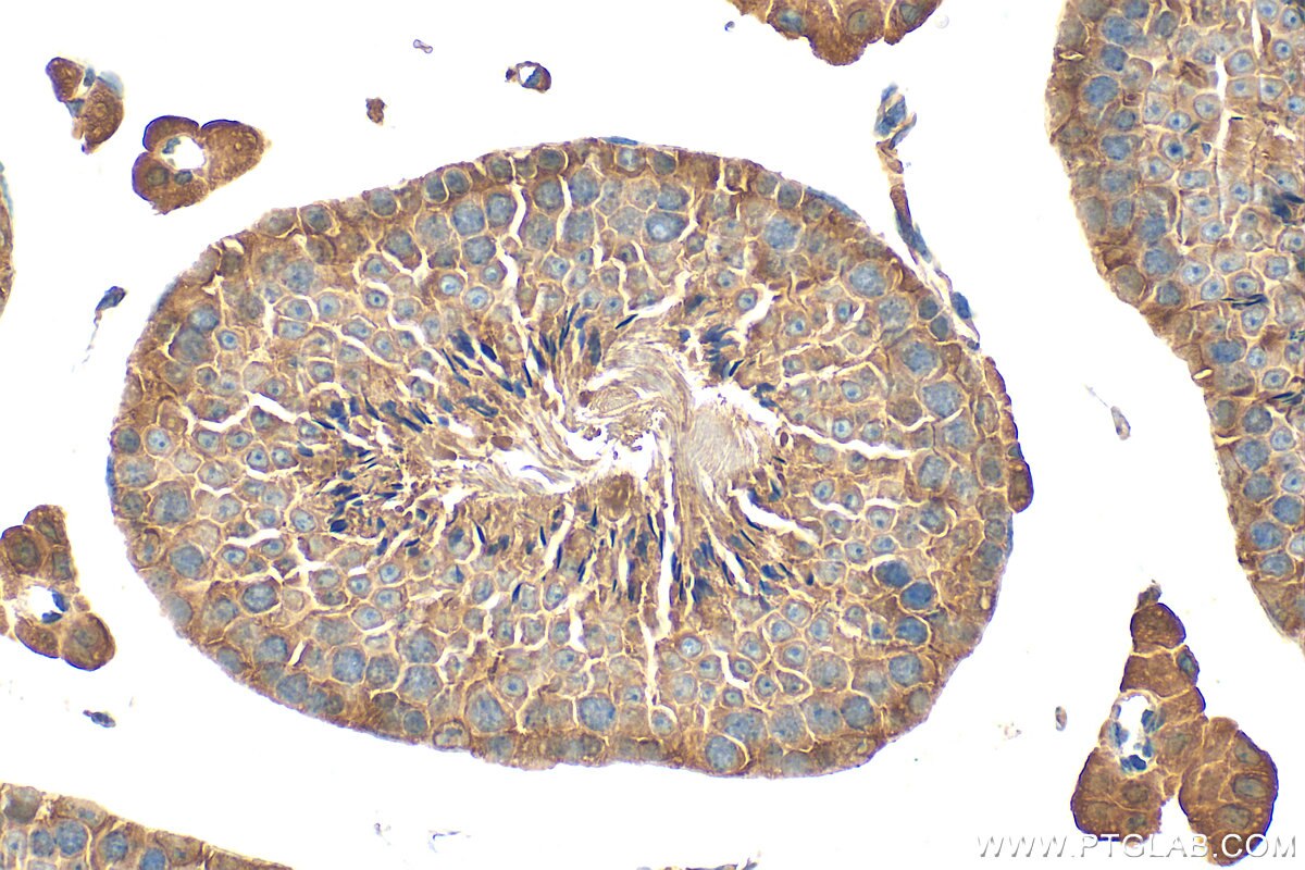 Immunohistochemistry (IHC) staining of mouse testis tissue using TRIML2 Polyclonal antibody (31976-1-AP)