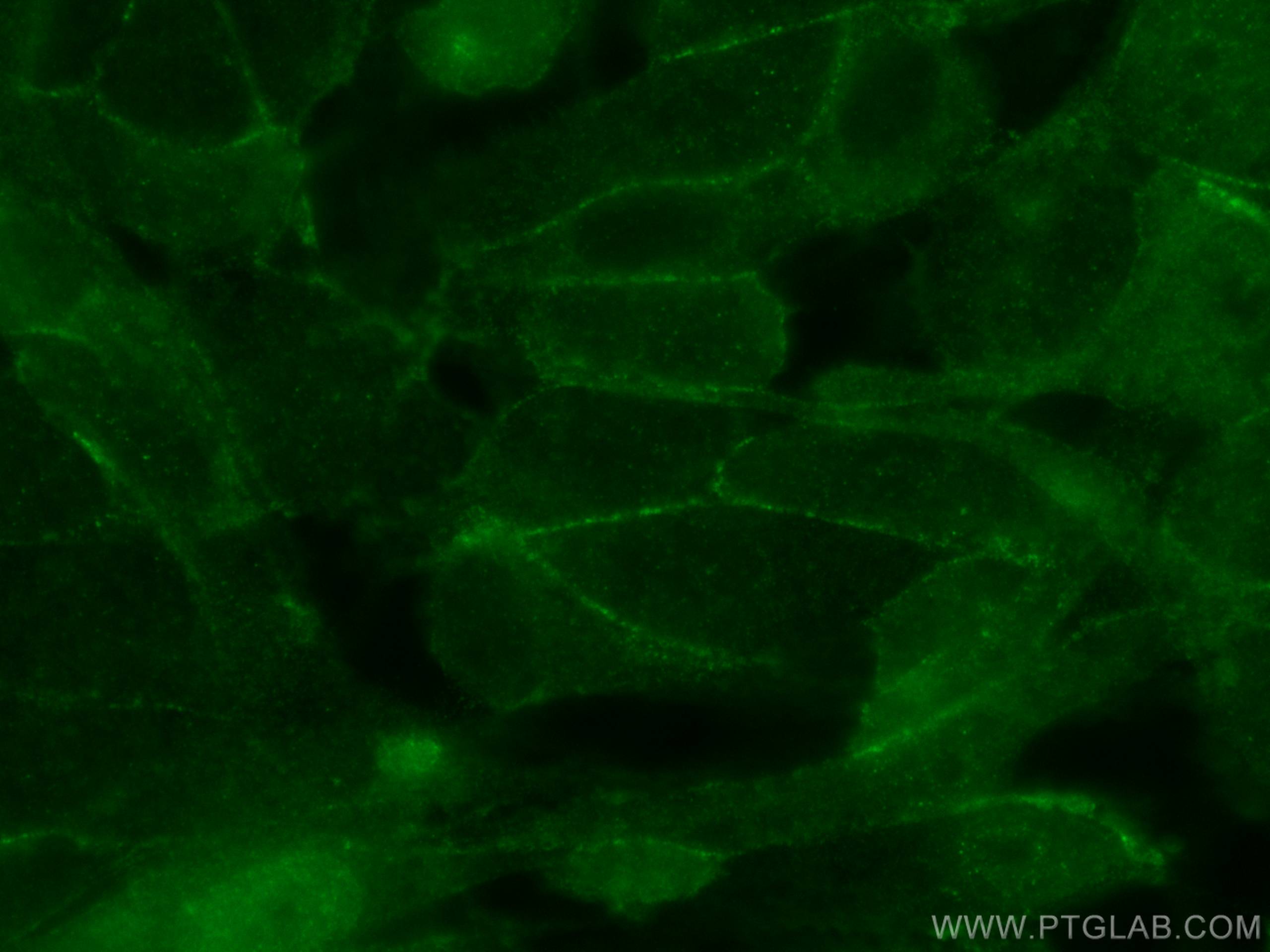 Immunofluorescence (IF) / fluorescent staining of MDCK cells using TRIOBP Polyclonal antibody (16124-1-AP)