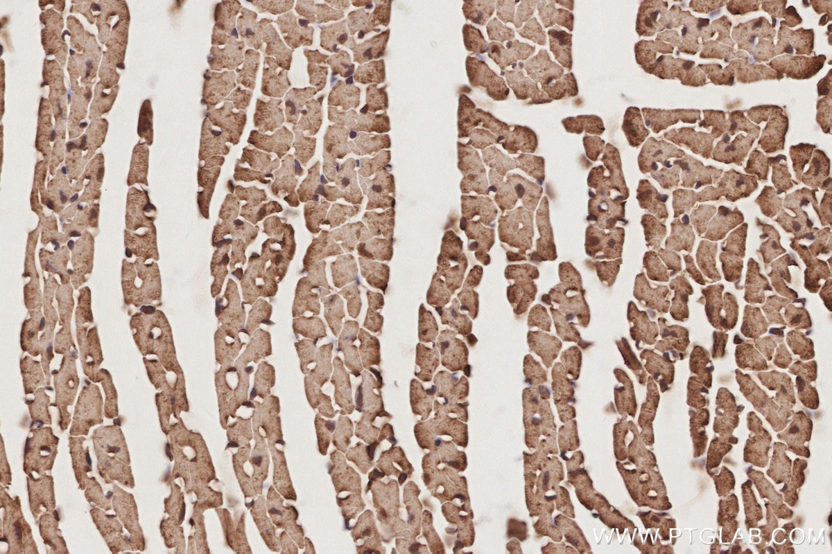 Immunohistochemistry (IHC) staining of mouse heart tissue using TRIOBP Polyclonal antibody (16124-1-AP)